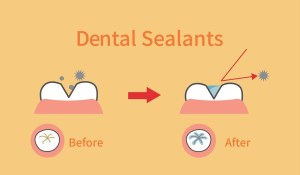 Before & After Diagram