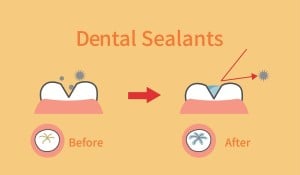 Before & After Diagram